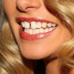 TEETH - teksty piosenek